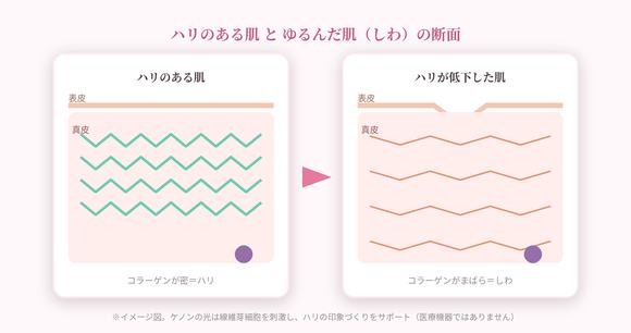 ハリのある肌とゆるんだ肌の断面イラスト